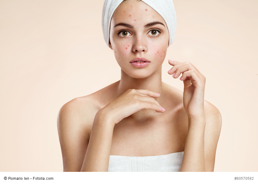 Scowling girl in shock of her acne with a towel on her head.